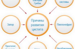 Причины цистита
